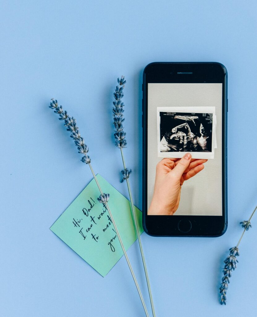 スマホにエコー写真とラベンダー